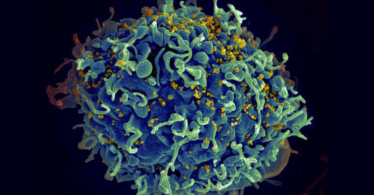HIV